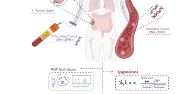 Liquid biopsy: shaping the future of cancer management beyond colorectal tumors