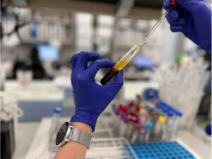 Liquid Biopsy Workshop: Applying multimodal liquid biopsy: from Prognostic to Prediction