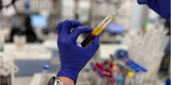 Liquid Biopsy Workshop: Applying multimodal liquid biopsy: from Prognostic to Prediction